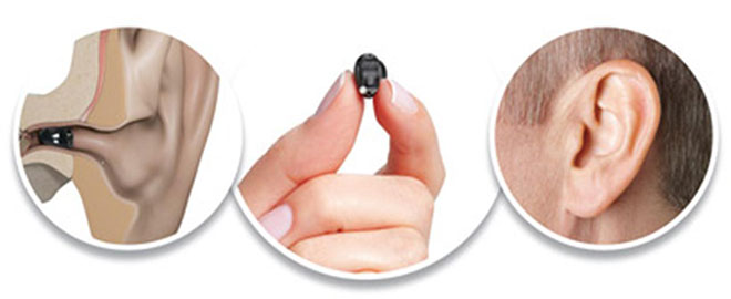 سمعک کاملا نامرئی