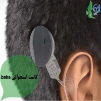 کاشت استخوانی baha