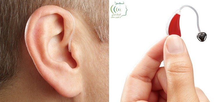 سمعک پشت گوشی 1