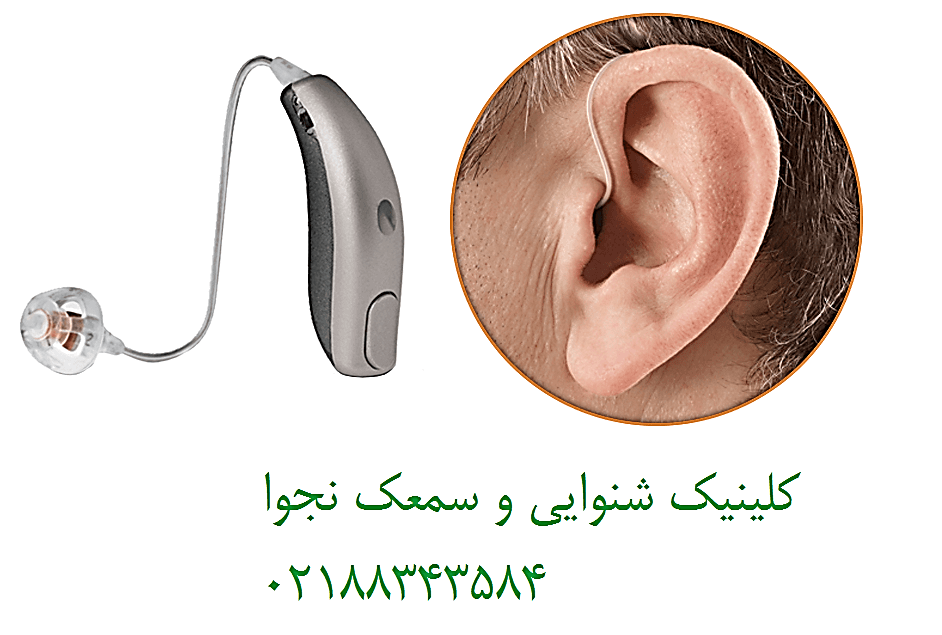 بیماری سخت شدگی استخوانچه های گوش (بیماری اتواسکلروزیس)