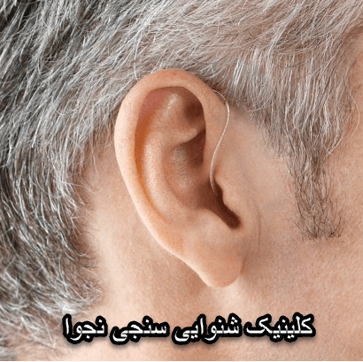وزوز گوش